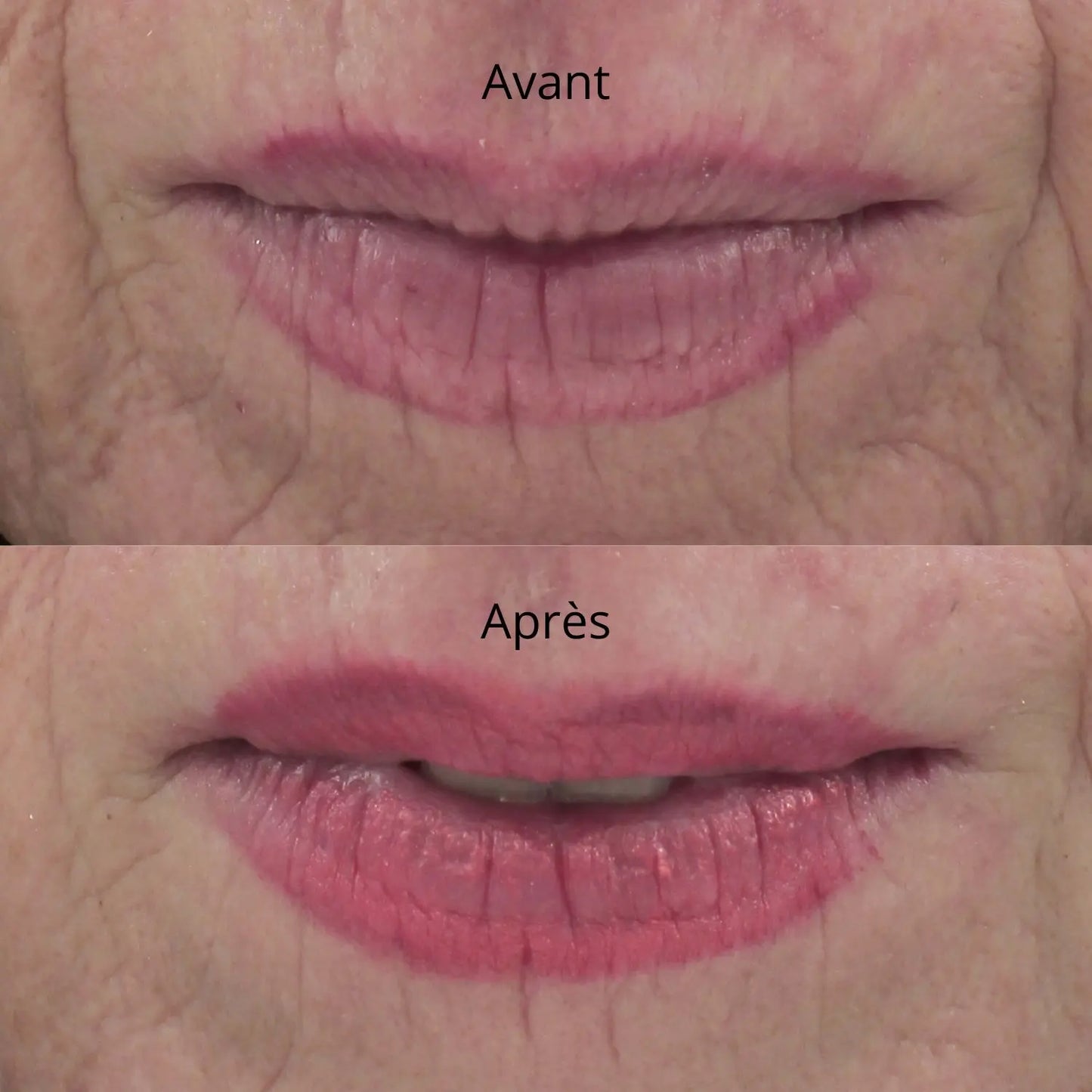Sérum Anti Picotements DRMTLGY